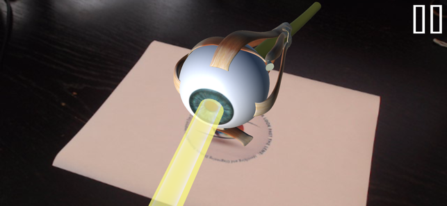 Diabetic Retinopathy AR