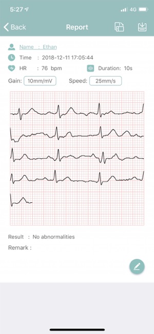 EMAY Portable ECG Monitor(圖3)-速報App