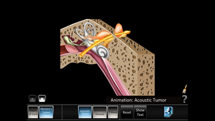 Ear Disorders: Inner screenshot-3