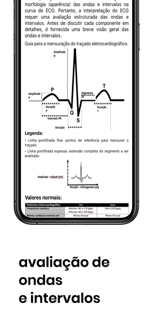 Accore ECG(圖4)-速報App