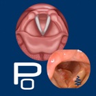 Vocal Pathology: Polyps