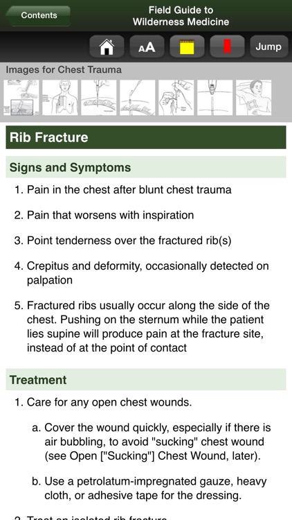 Field Guide Wilderness Med. 4E