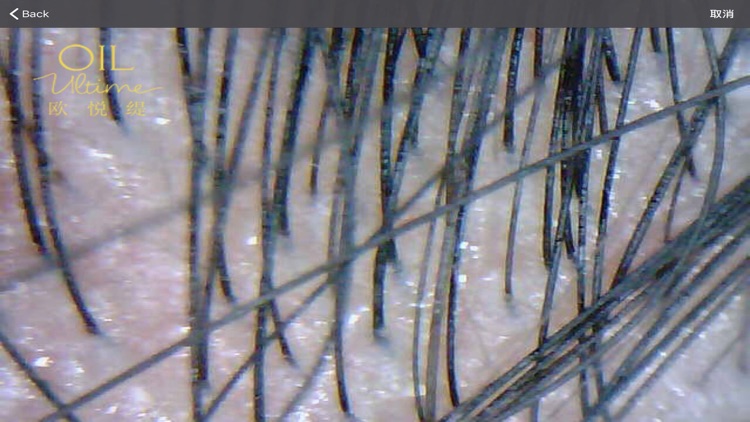 欧悦缇头皮检测