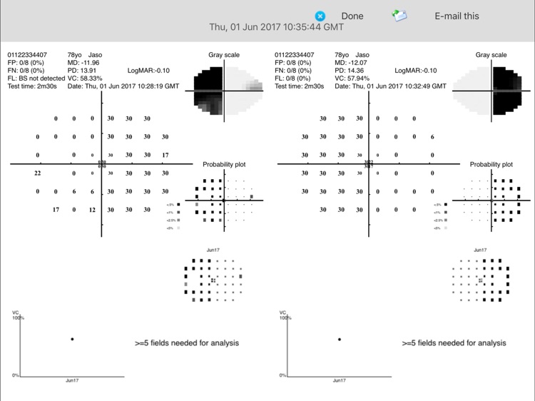 MRF Neural