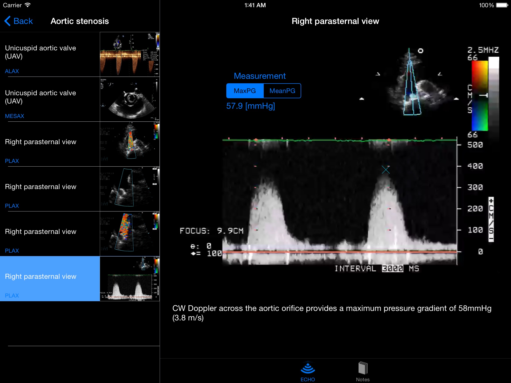 CARDIO3®Echocardiography HD screenshot 2