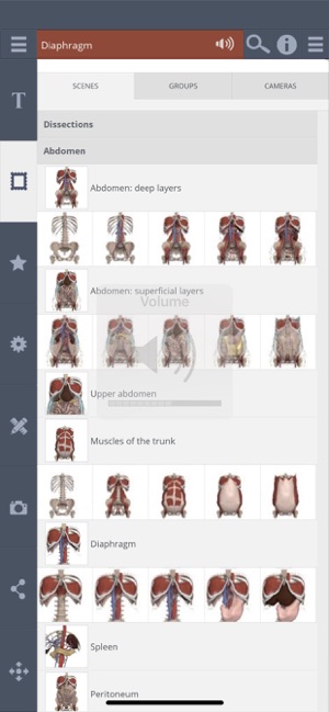 Abdomen: 3D Real-time(圖3)-速報App