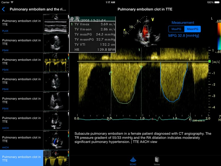 CARDIO3®Echocardiography HD screenshot-3