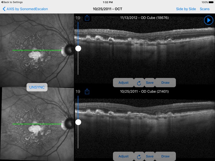 SonomedEscalon Axis screenshot-3