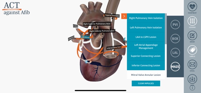 ACT 3D Heart(圖3)-速報App