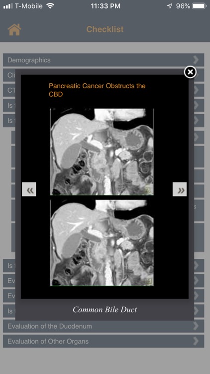 CTisus Pancreas Mass Checklist screenshot-3