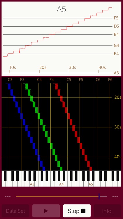 Vocalise Scope