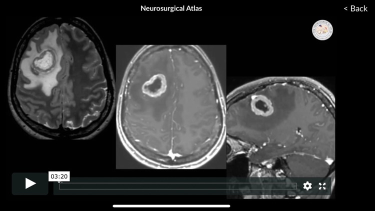 Neurosurgical Atlas screenshot-5