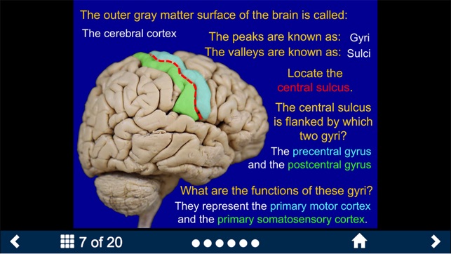 Neuroanatomy - SecondLook(圖2)-速報App