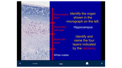 How to cancel & delete Histology Lite - SecondLook from iphone & ipad 3