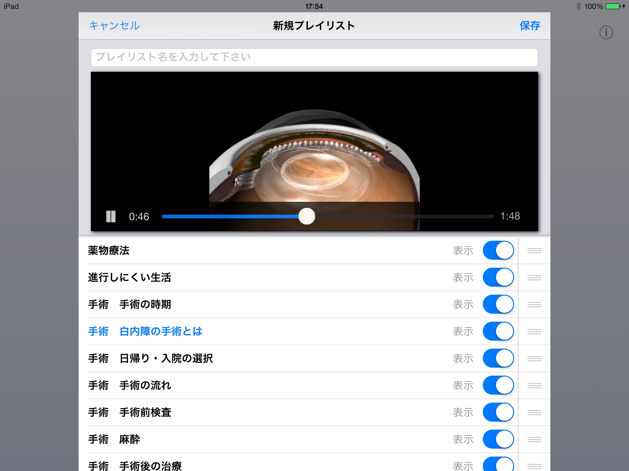 iCeye 白内障 screenshot 3