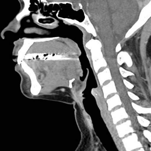 CT Neck iOS App