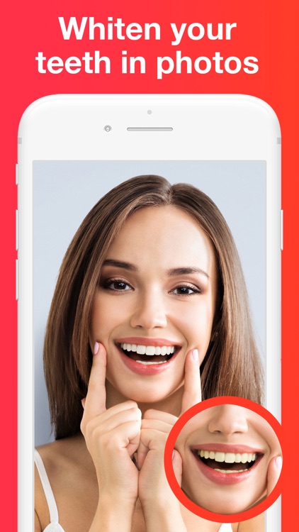 Teeth Whitener 2