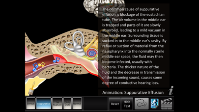 How to cancel & delete Otitis Media Disorders from iphone & ipad 2