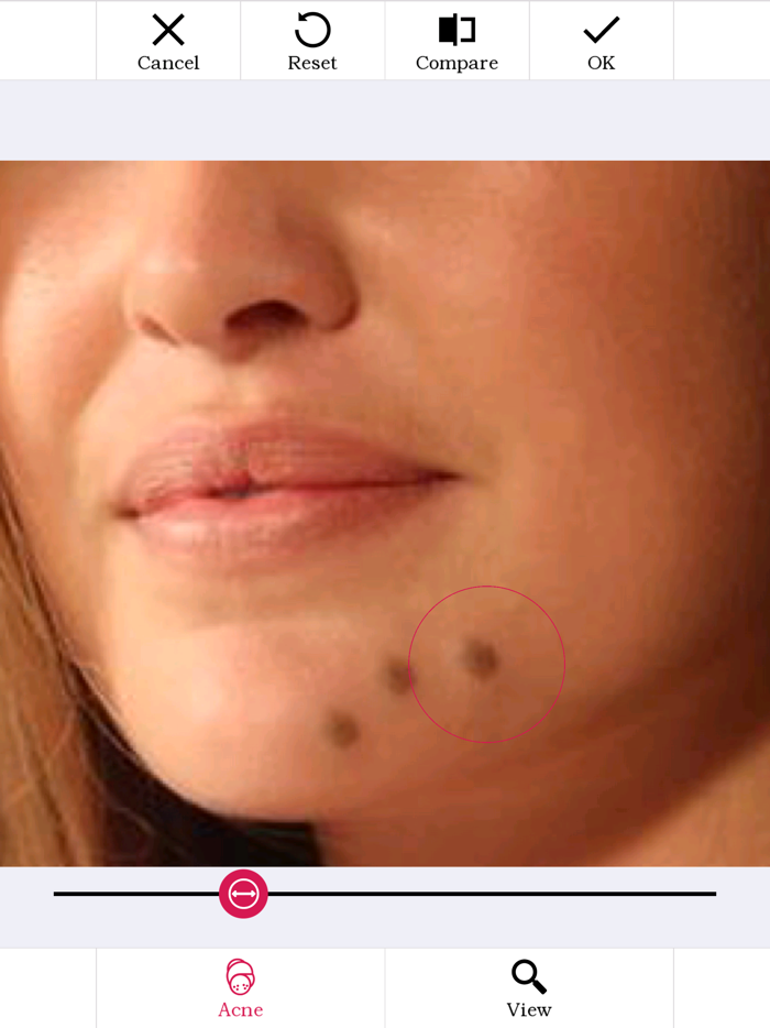 Photo Plastic Surgery Pro