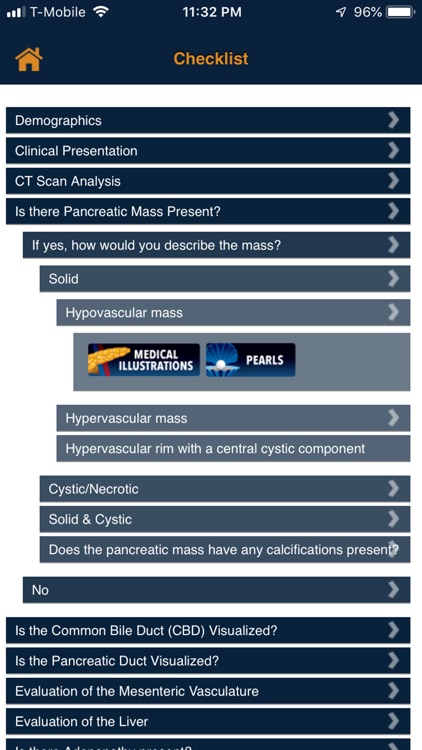 CTisus Pancreas Mass Checklist