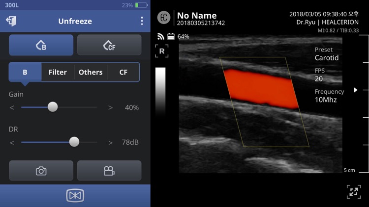 SONON Ultrasound App