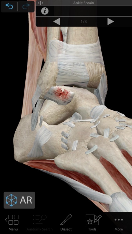 Muscles & Kinesiology screenshot-6