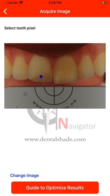 Dental Shade Navigator