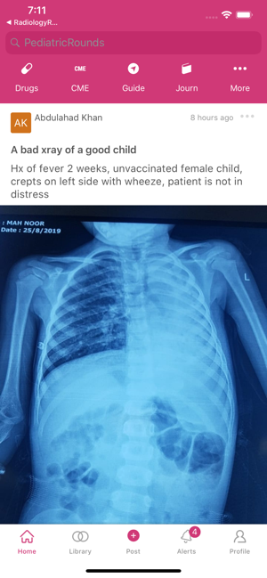 Pediatric Rounds