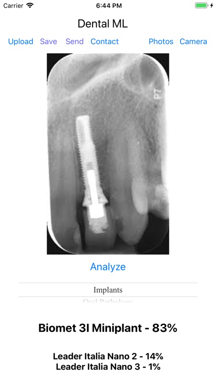 Dental ML