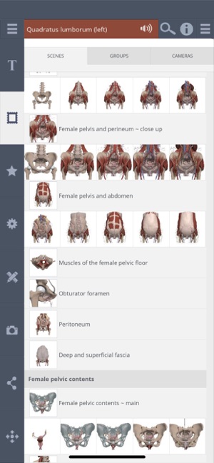 Female Pelvis: 3D Real-time(圖2)-速報App