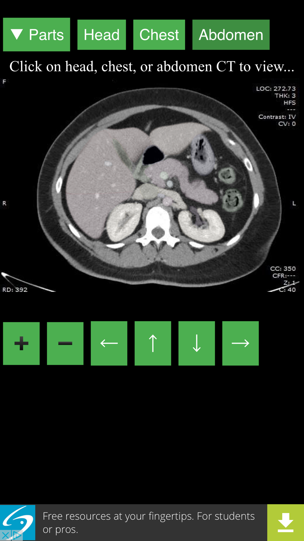 Anatomy On Radiology Ct Free Download App For Iphone Steprimo Com
