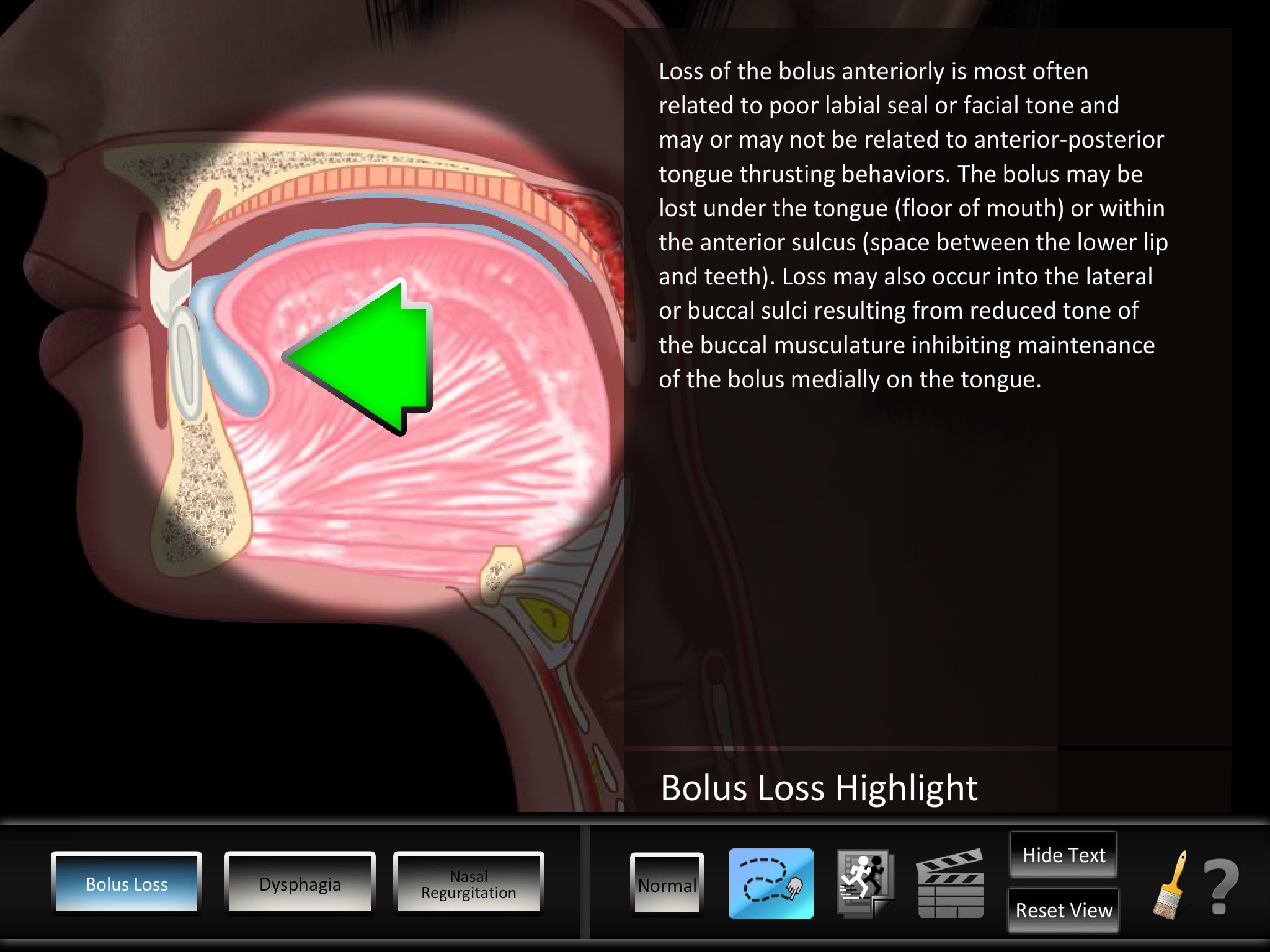 Oral Disorders screenshot 2