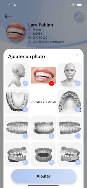 Aligneurs Français(圖3)-速報App