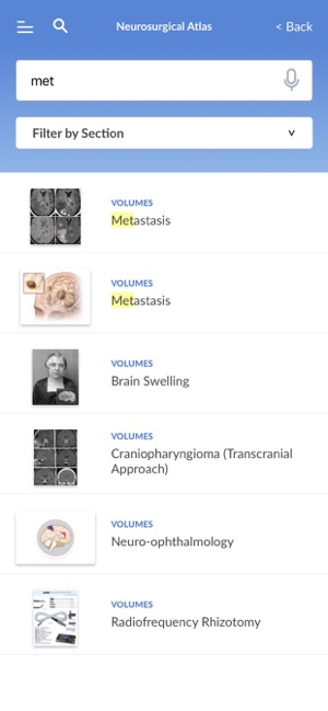 Neurosurgical Atlas(圖2)-速報App