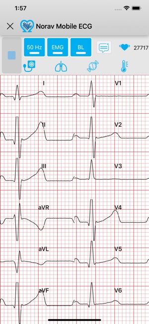 Norav Medical Mobile ECG(圖3)-速報App