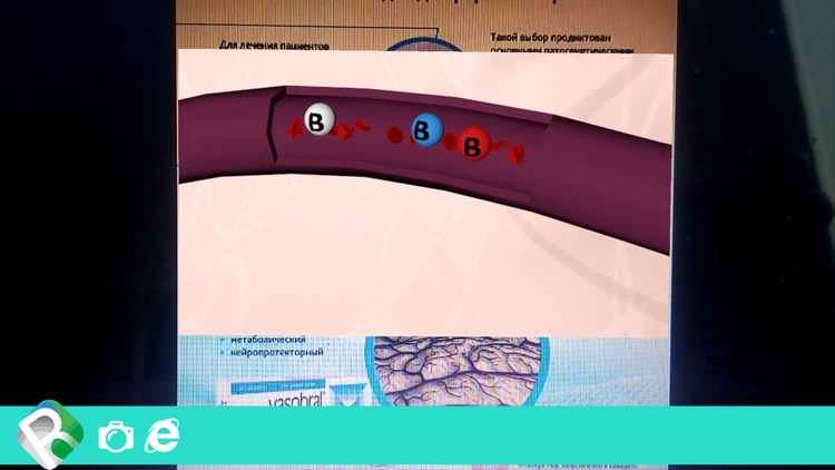 Vasobral-VS-CVD