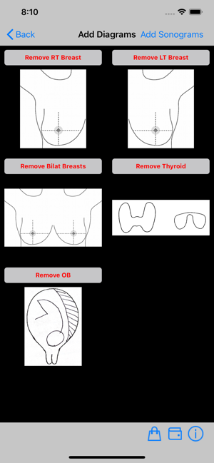 Ultrasound Reporting Tool(圖3)-速報App