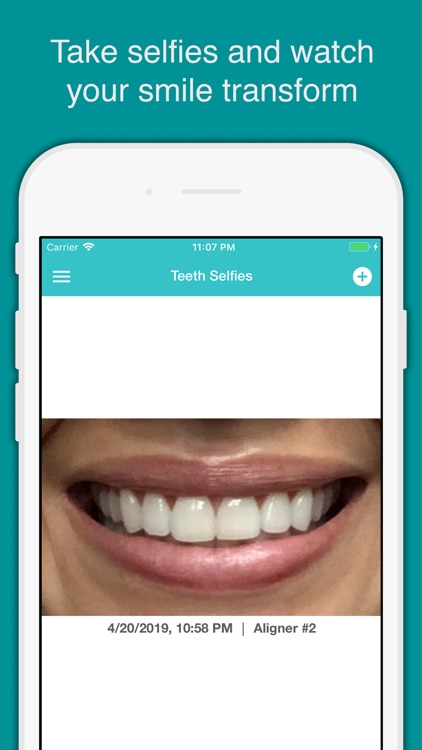 TrayMinder Aligner Tracker