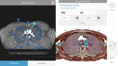 Human Anatomy Atlas 2017 - Complete 3D Human Body Screenshot 5