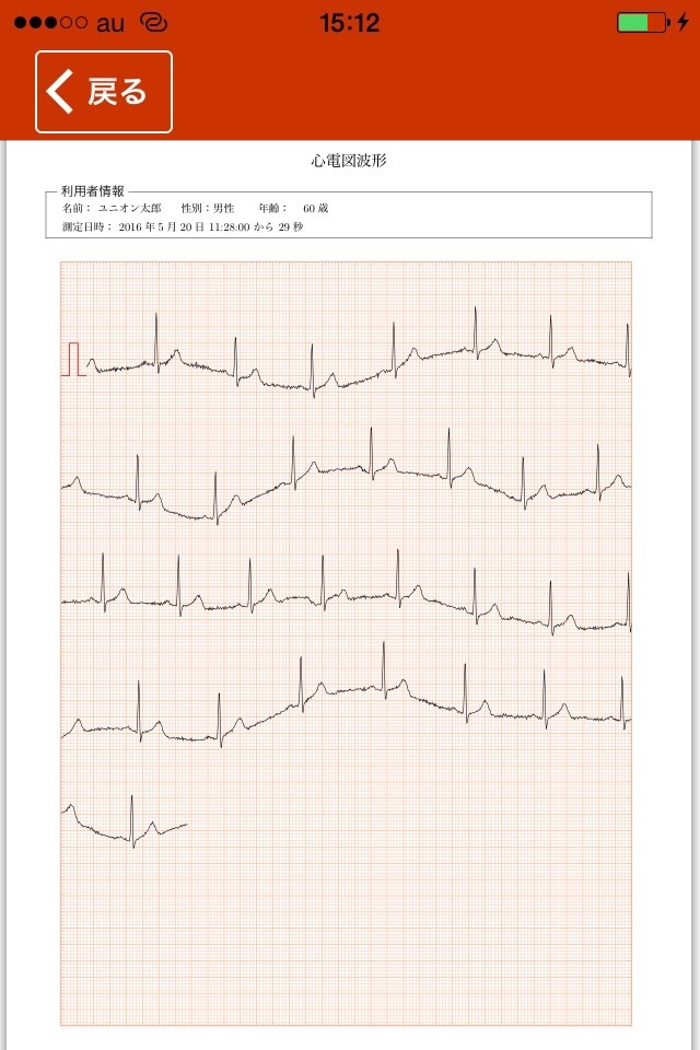 myBeat 心電計 screenshot 4