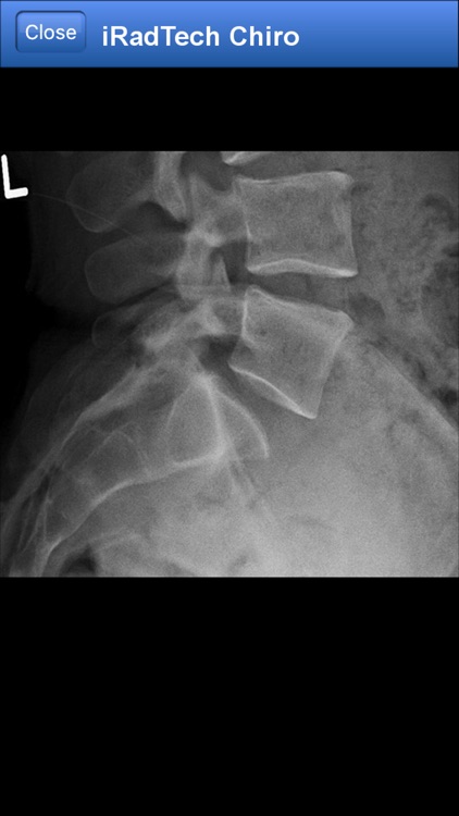 iRadTech Chiro screenshot-5