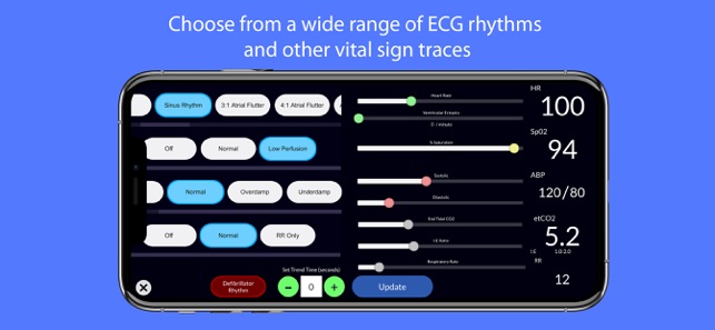 Simpl Patient Monitor(圖3)-速報App