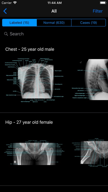 Normal X-Rays and Real Cases screenshot-0