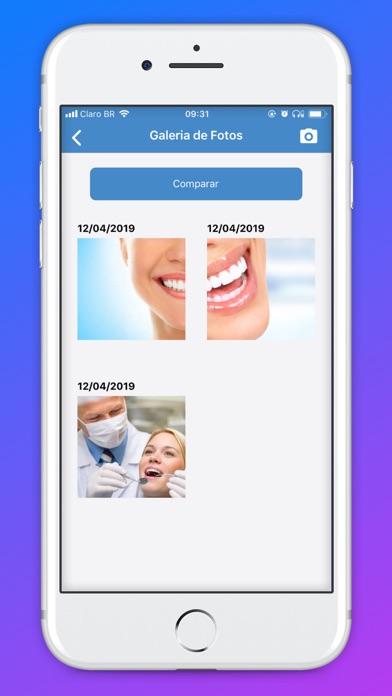 Esthetic Aligner screenshot 4