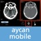 Demo account: User: aycan PW: aycan