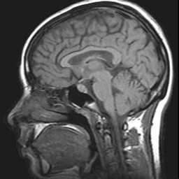 MRI Viewer
