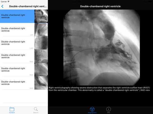 CARDIO3®Invasive Cardiology HD(圖5)-速報App