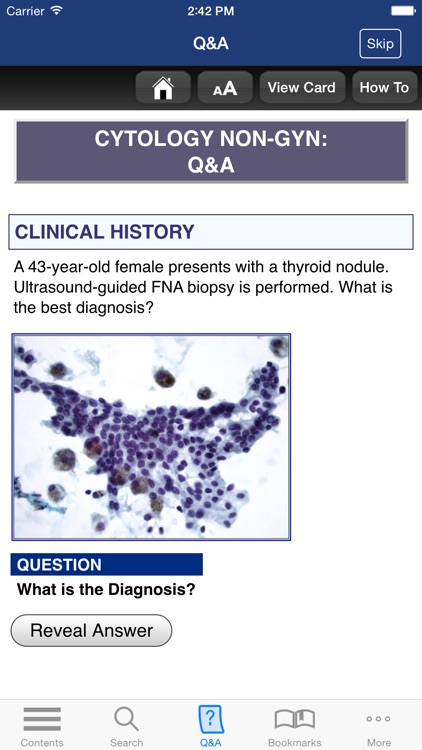 Anatomic Pathology Flashcards screenshot-3