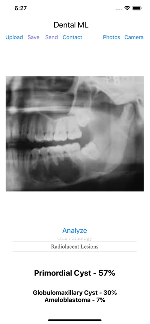 Dental ML(圖3)-速報App