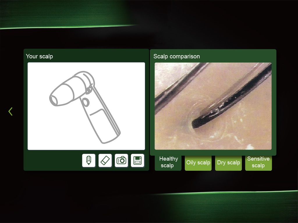 Scalp Analyzer screenshot 2